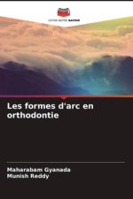 Les formes d'arc en orthodontie