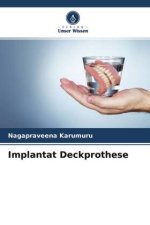 Implantat Deckprothese