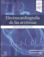 Electrocardiografía de las arritmias