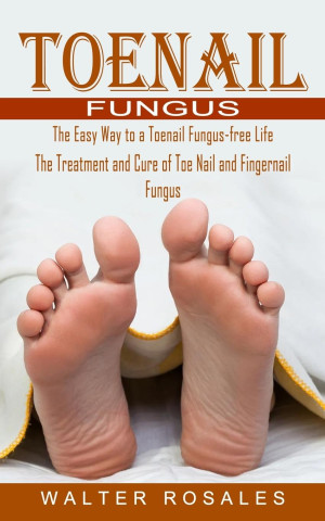 Toenail Fungus