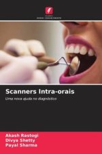 Scanners Intra-orais