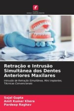 Retraç?o e Intrus?o Simultânea dos Dentes Anteriores Maxilares