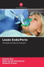 Les?o Endo/Perio