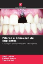 Pilares e Conex?es de Implantes