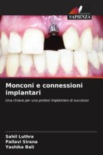 Monconi e connessioni implantari