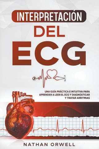 Interpretacion del ECG