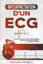 Interpretation d'un ECG