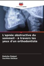 L'apnée obstructive du sommeil - ? travers les yeux d'un orthodontiste