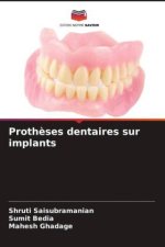 Proth?ses dentaires sur implants