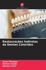Restauraç?es Indiretas de Dentes Coloridos