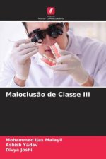 Maloclus?o de Classe III