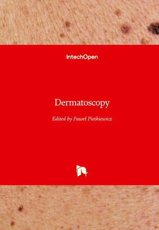 Dermatoscopy