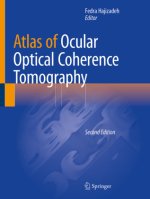 Atlas of Ocular Optical Coherence Tomography