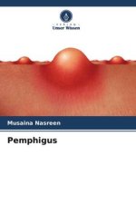 Pemphigus
