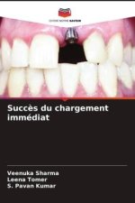 Succ?s du chargement immédiat