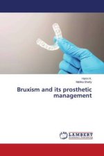 Bruxism and its prosthetic management
