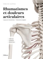 Rhumatismes et douleurs articulaires - Causes et mécanismes - Traitements adaptés