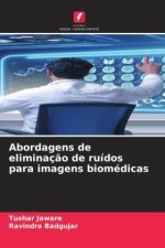 Abordagens de eliminaç?o de ruídos para imagens biomédicas