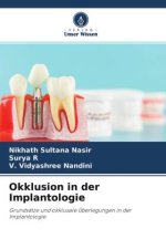Okklusion in der Implantologie