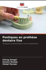 Pontiques en proth?se dentaire fixe