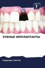 ZUBNYE IMPLANTANTY