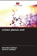 Lichen planus oral