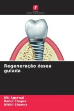 Regeneraç?o óssea guiada