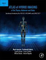 Atlas of Hybrid Imaging of the Heart, Lymph Nodes and Musculoskeletal System, Volume 3