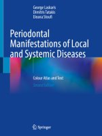 Periodontal Manifestations of Local and Systemic Diseases