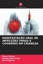MANIFESTAÇ?O ORAL DE INFECÇ?ES VIRAIS E COVARDES EM CRIANÇAS