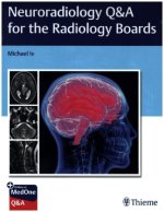 Neuroradiology Q&A for the Radiology Boards