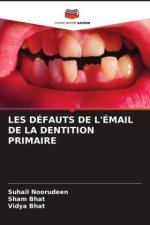 LES DÉFAUTS DE L'ÉMAIL DE LA DENTITION PRIMAIRE