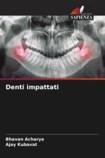 Denti impattati