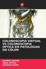 COLONOSCOPIA VIRTUAL VS COLONOSCOPIA ÓPTICA EM PATOLOGIAS DO CÓLON