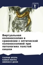 Virtual'naq kolonoskopiq w srawnenii s opticheskoj kolonoskopiej pri patologiqh tolstoj kishki