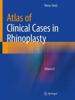 Atlas of Clinical Cases in Rhinoplasty