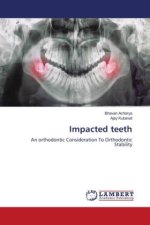 Impacted teeth