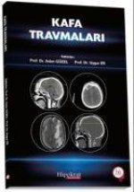 Kafa Travmalari