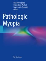 Pathologic Myopia