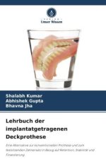 Lehrbuch der implantatgetragenen Deckprothese