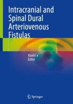 Intracranial and Spinal Dural Arteriovenous Fistulas