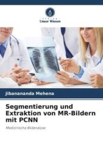 Segmentierung und Extraktion von MR-Bildern mit PCNN