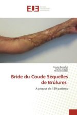 Bride du Coude Séquelles de Br?lures