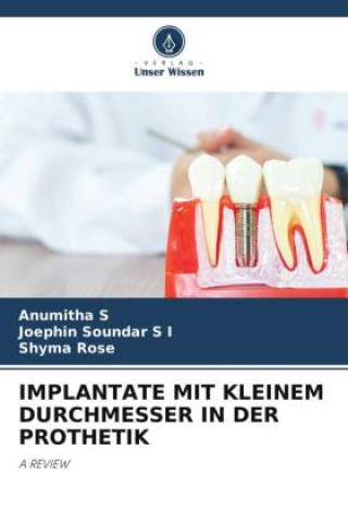 IMPLANTATE MIT KLEINEM DURCHMESSER IN DER PROTHETIK