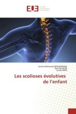 Les scolioses évolutives de l?enfant