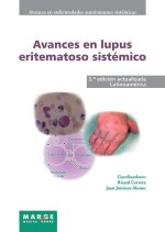 Avances en lupus eritematoso sistémico