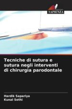 Tecniche di sutura e sutura negli interventi di chirurgia parodontale