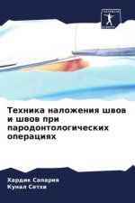 Tehnika nalozheniq shwow i shwow pri parodontologicheskih operaciqh
