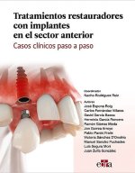 Tratamientos restauradores con implantes en el sector anterior. Casos clínicos paso a paso.