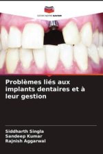 Probl?mes liés aux implants dentaires et ? leur gestion